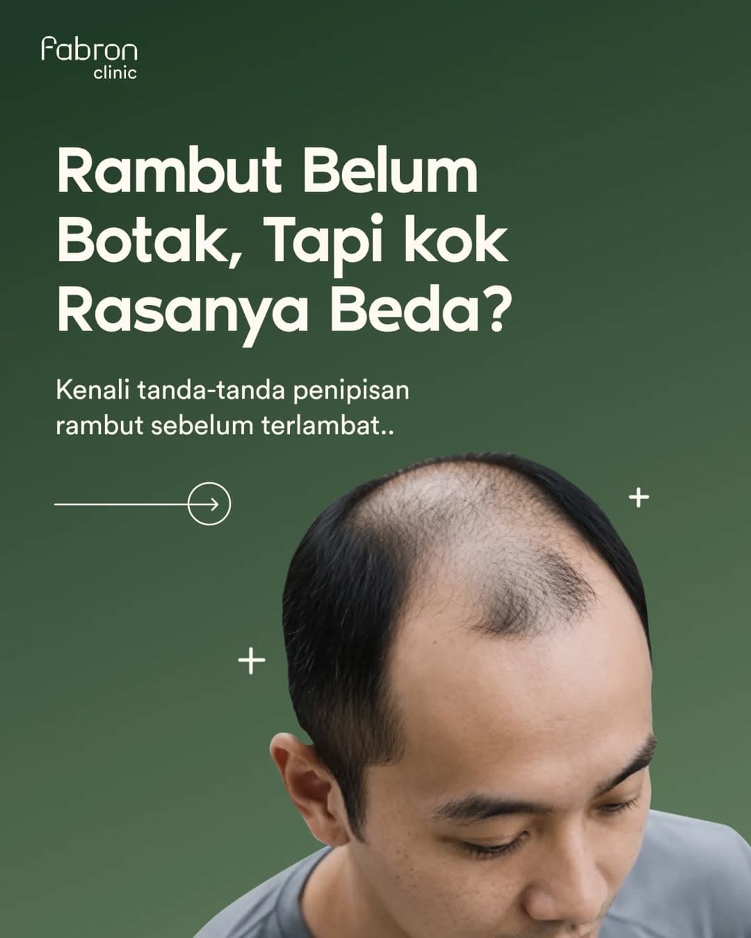 Hair Loss Treatment Fabron Clinic
